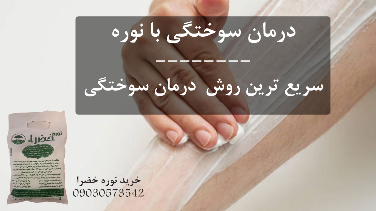 درمان سوختگی با نوره